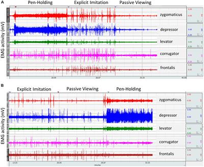 Incongruence Between Observers’ and Observed Facial Muscle Activation Reduces Recognition of Emotional Facial Expressions From Video Stimuli